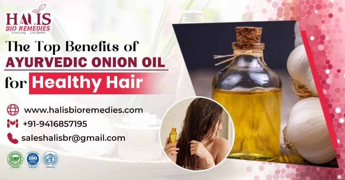 Top Benefits of Ayurvedic Onion Oil for Healthy Hair | Topmost Ayurvedic and Herbal PCD Franchise Company in India